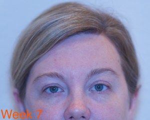 Clarisonic Opal Week 7 -eyes